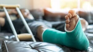 A close-up shot of a man’s leg in a cast