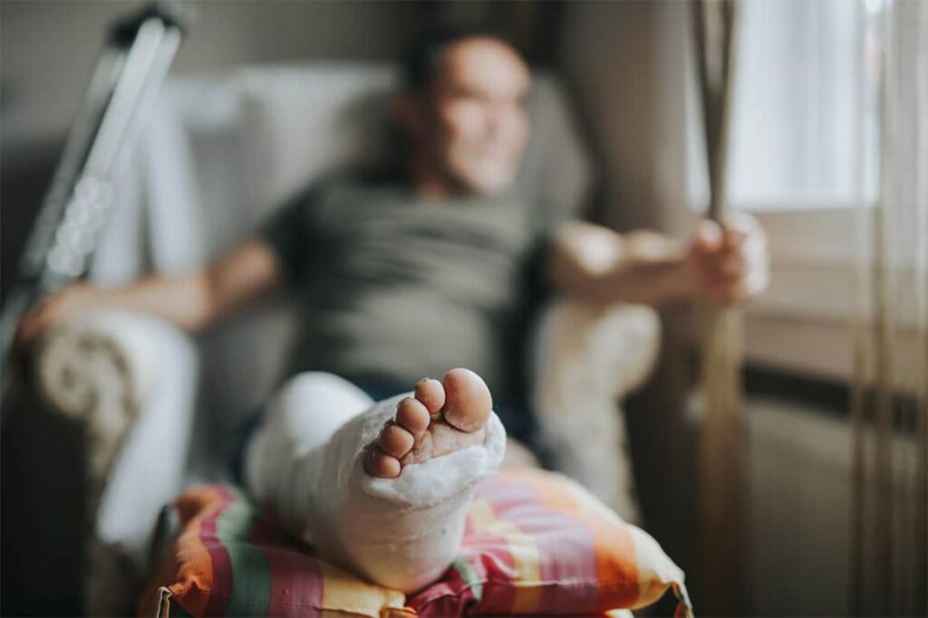 Man with broken leg at home
