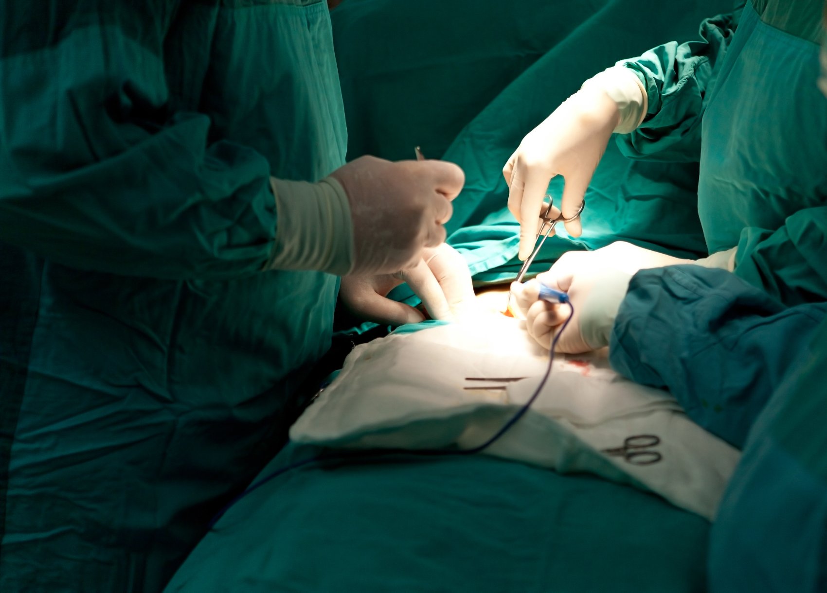 Surgeons performing a procedure in an operating room.